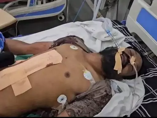 दिवाली की खुशियां बनी खून में लथपथ… पत्नी से झगड़े के बाद युवक ने खुद पर चलाया चाकू, अस्पताल में जिंदगी और मौत के बीच जंग