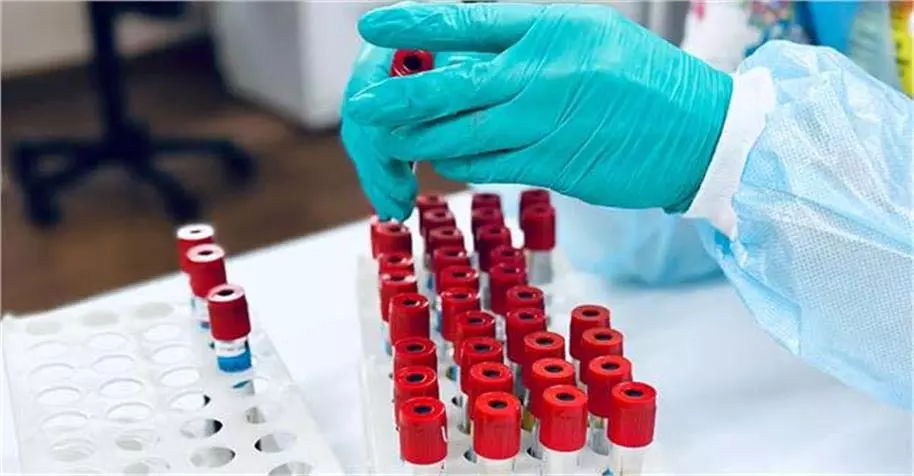 Blood Group: A वाले लोगों में लिवर डैमेज का खतरा ज्यादा