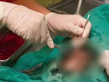 दुर्ग जिला अस्पताल में नसबंदी के दौरान दो महिलाओं की मौत