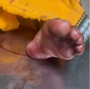 राजधानी में हाई अलर्ट के बीच चाकूबाजी, भाई पर हमला कर घायल