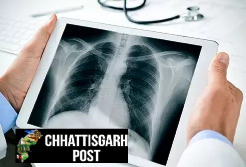 विधायक रिकेश के कार्यालय में बड़ी सुविधा: 1 रुपए में एक्स-रे, स्वास्थ्य जांच अब सबके लिए आसान