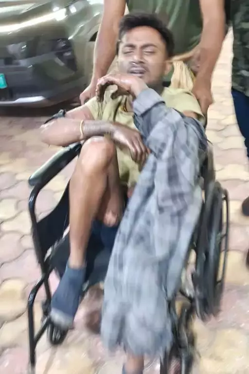 बिलासपुर में स्पंज आयरन प्लांट में बड़ा हादसा! फर्नेस से उछला खौलता लोहा, 4 मजदूर बुरी तरह झुलसे