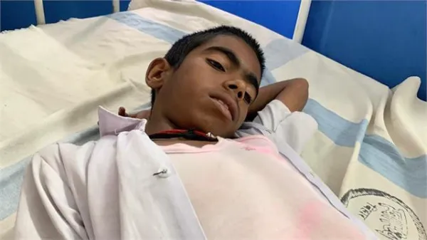 मुर्गा पार्टी का राज खोला तो बना शिकार! प्रिंसिपल की हैवानियत से छात्र के फेफड़े तक जख्मी