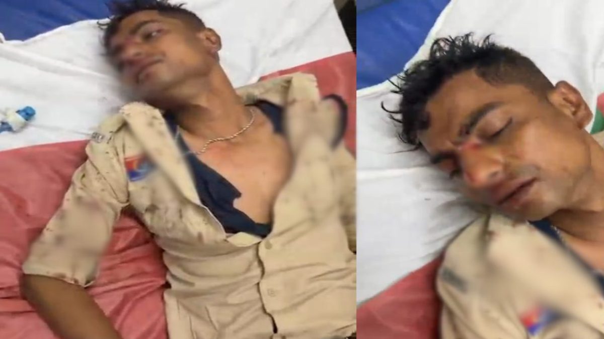डायल-112 पहुंची थी झगड़ा शांत कराने, तभी भड़क उठा सिरफिरा; आरक्षक के सिर पर बरसाया डंडा, खून से लथपथ हुआ जवान