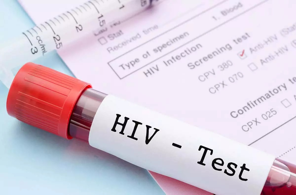 HIV संक्रमितों में बढ़ा आक्रोश! गोपनीयता भंग होने के आरोप, जीवनरक्षक दवा छोड़ने की चेतावनी HIV संक्रमितों में बढ़ा आक्रोश! गोपनीयता भंग होने के आरोप, जीवनरक्षक दवा छोड़ने की चेतावनी